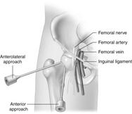 Image result for hip joint